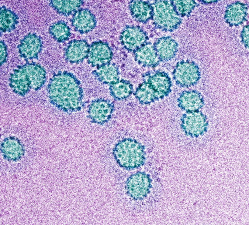 无人,横图,俯视,室内,特写,白天,仪器,微生物,检查,反射,分析,科学,医学,显微镜,绿色,紫色,观察,生物,清晰,探索,放大,观看,仔细,透镜,医疗,病毒,生物学,凸透镜,聚焦,关注,光学,清楚,寄生,生命体,生物病毒,DNA病毒,显微图片,彩图,高角度拍摄,透射电子显微镜,人类乳头瘤病毒,人乳头状瘤病毒,乳头多瘤空泡病毒