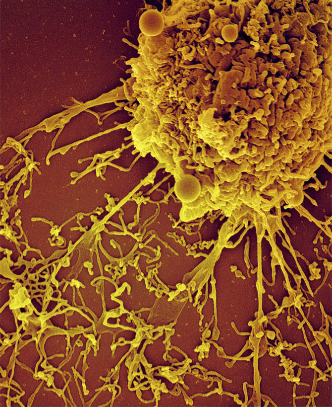 无人,竖图,俯视,室内,特写,白天,仪器,科技,微生物,检查,反射,分析,科学,医学,细胞,显微镜,黄色,观察,怀孕,清晰,探索,放大,观看,仔细,透镜,医疗,生物学,科学技术,凸透镜,聚焦,关注,人工受精,试管婴儿,光学,清楚,显微图片,彩图,高角度拍摄,扫描电镜,扫描电子显微镜,体外受精,体外受孕