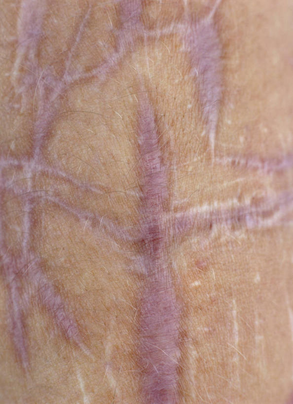 西方人,一个人,竖图,室内,特写,白天,正面,欧洲,欧洲人,仅一个女性,仅一个人,纹路,纹理,痕迹,仅一个中年女性,皮肤,疤痕,肌理,伤害,自残,伤疤,伤痕,女人,女性,中年女性,白种人,半身,彩图