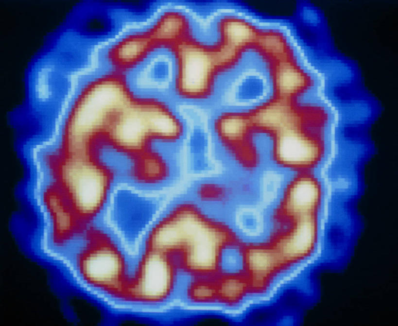 脑,脊髓,无人,横图,室内,白天,正面,机器,数码,科技,阴影,黑色背景,辐射,网络,医学,高光,几何,计算机图形,合成,设备,红色,蓝色,电脑合成图,数码合成图,医疗,医疗设备,疾病,合成图,医疗器械,医疗工具,写实,具体,具象,脊神经,脑神经,中枢神经系统,周围神经系统,精神病,精神分裂,检测工具,脊柱,彩图,调节系统,植物性神经,周围神经,精神分裂症,精神科疾病,神经系统,中枢神经,电磁波,电磁辐射,正电子发射计算机断层扫描,PET扫描仪,正电子发射计算机断层扫描仪