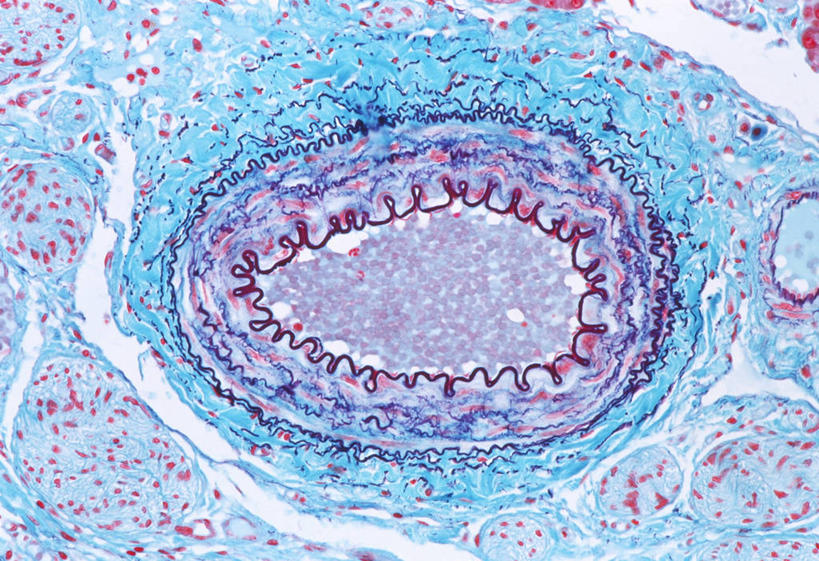 内脏,心脏,动脉,静脉,血管,无人,横图,俯视,室内,特写,白天,仪器,检查,反射,分析,科学,医学,显微镜,蓝色,观察,清晰,探索,人体,放大,观看,仔细,透镜,疾病,生物学,心血管系统,人体器官,凸透镜,聚焦,器官,封闭,关注,心血管,心房,心室,光学,清楚,外耳炎,血液循环,显微图片,自然科学,博物学,生物科学,心,彩图,高角度拍摄,扫描电镜,扫描电子显微镜,管道系统,局限性外耳道炎,外耳道疖肿,外耳道炎