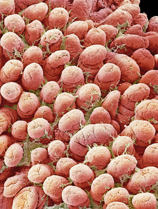 无人,竖图,室内,白天,正面,仪器,微生物,检查,反射,分析,科学,医学,纹路,纹理,细胞,显微镜,观察,清晰,探索,放大,观看,仔细,透镜,生物学,凸透镜,聚焦,关注,肌理,光学,清楚,微绒毛,细胞质,显微图片,小肠,彩图,扫描电镜,胞浆,扫描电子显微镜,绒毛状突起,细绒毛