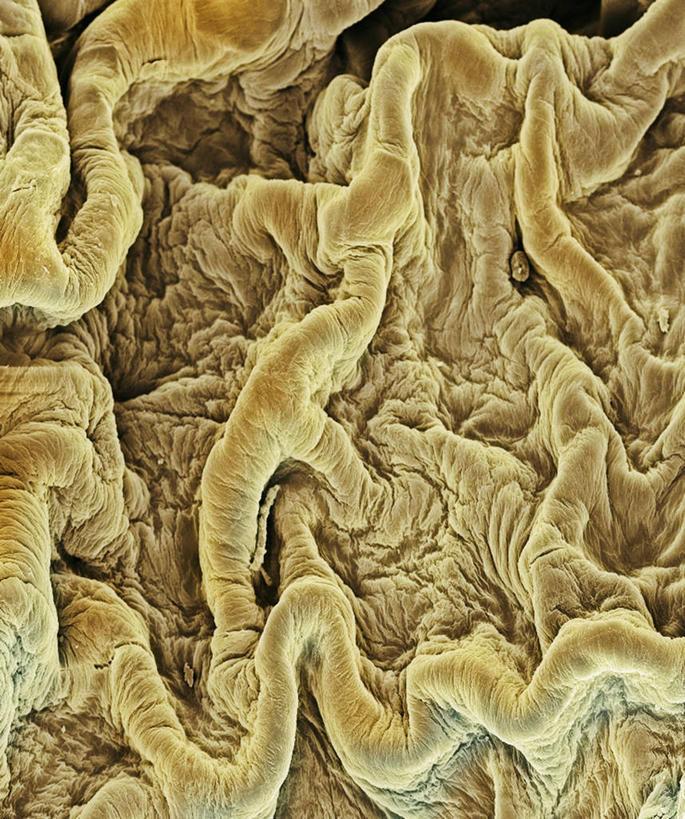 肾脏,膀胱,尿道,无人,竖图,室内,白天,正面,仪器,检查,反射,分析,科学,纹路,纹理,显微镜,观察,清晰,探索,放大,观看,仔细,透镜,凸透镜,聚焦,关注,泌尿系统,输尿管,肌理,光学,清楚,排泄,显微图片,彩图,代谢,扫描电镜,扫描电子显微镜