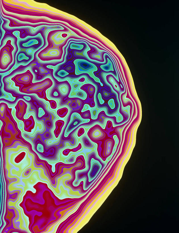 乳房,无人,竖图,插画,室内,白天,正面,数码,科技,微生物,阴影,黑色背景,科学,网络,医学,细胞,高光,几何,计算机图形,合成,图画,画,纤维,电脑合成图,数码合成图,生物学,合成图,漫画,写实,具体,具象,乳腺,结缔组织,显微图片,自然科学,博物学,生物科学,彩图,组织细胞,基本组织,基质,细胞外间质