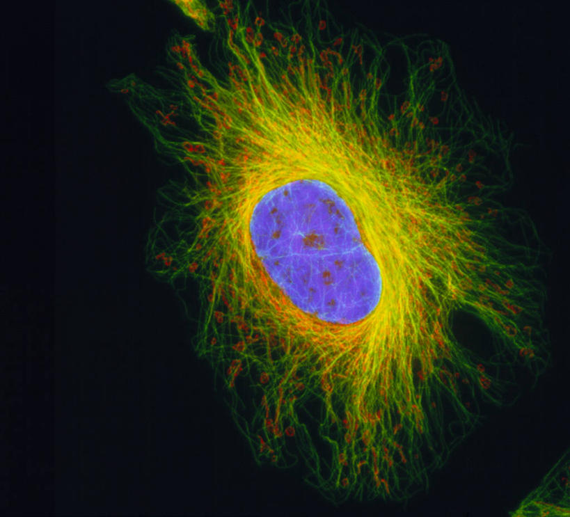 无人,横图,室内,白天,正面,仪器,微生物,检查,反射,分析,科学,细胞核,医学,纹路,纹理,细胞,显微镜,紫色,观察,清晰,探索,放大,观看,仔细,透镜,核仁,细胞器,生物学,凸透镜,聚焦,关注,肌理,光学,清楚,纤维细胞,显微图片,彩图,扫描电镜,核骨架,核膜,扫描电子显微镜