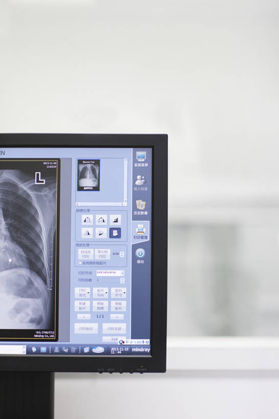 骨骼,无人,办公室,医院,竖图,x光片,室内,特写,机器,显示器,技术,窗户,玻璃,北京,中国,亚洲,检查,辐射,科学,医学,器材,放射,设备,现代,医疗用品,观察,职业,机械,服务,人体,摄影,技巧,部分,控制,体检,察看,检测,医疗,医疗设备,胸腔,科学技术,操作,x射线,调查,手艺,医疗器械,x光,医疗工具,监控,监视,考察,东亚,控制室,监控设备,CAT扫描仪,无线电技术,观测,视察,无线电波,监控设置,监控装备,检测器,技能,技艺,检测工具,计算机,彩图,计算机X射线轴向分层造影扫描仪,计算机轴向断层扫描,妙技,x射线衍射,x射线衍射仪,射线检测器,电磁波,电磁辐射,本领,放射疗法,体格检查,bj175